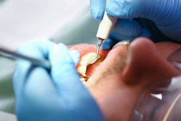 Best Dentist for Tooth Abscess  in Montrose, NY